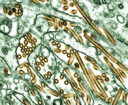 Colorized transmission electron micrograph of Avian influenza A H5N1 viruses.jpg
